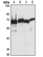 Anti-I-plastin Antibody