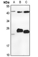 Anti-PMVK Antibody