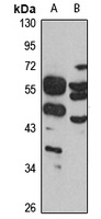 Anti-PNKD Antibody