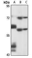 PNLDC1 antibody