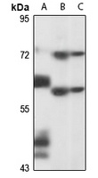 Anti-PNLDC1 Antibody