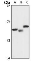Anti-PLRP1 Antibody