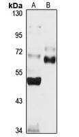 Anti-Podocan Antibody