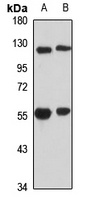 Anti-POLR1E Antibody