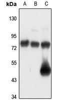 Anti-POMGNT2 Antibody