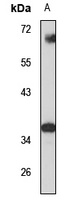 Anti-PPA2 Antibody