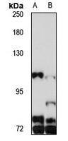 Anti-PGC-1-beta Antibody
