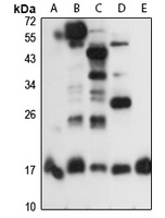 Anti-PPIL1 Antibody