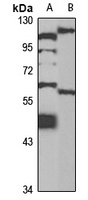 WIP1 antibody