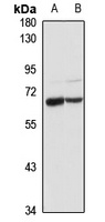 PPM1J antibody