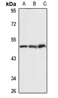 Anti-PPME1 Antibody