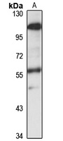 Anti-PPP2R5B Antibody