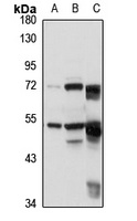 Anti-PPP2R5E Antibody