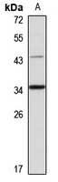 Anti-PPT2 Antibody