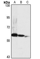 PRAME antibody