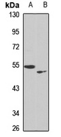 PRAMEF20/21 antibody