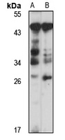 PRB4 antibody