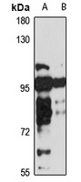 Anti-PRDM1 Antibody