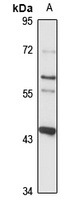 Anti-PRDM12 Antibody