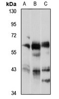 Anti-AMPK alpha 1/2 Antibody