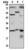 PRKRIP1 antibody