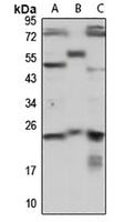 Anti-PRKRIP1 Antibody