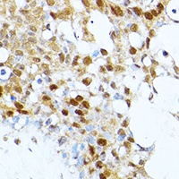 PRMT1 Rabbit Polyclonal Antibody