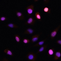 PRMT1 Rabbit Polyclonal Antibody