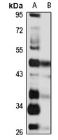 GPR73b antibody