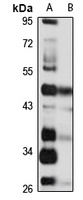 Anti-GPR73b Antibody