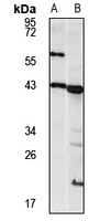 PRPSAP1 antibody