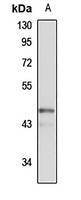 Anti-PRR5 Antibody