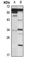 Anti-PRRT2 Antibody