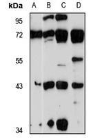 Anti-PRSS23 Antibody