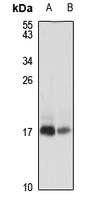 Anti-PEN-2 Antibody