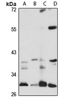 Anti-PSMB7 Antibody