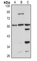 Anti-PSMC1 Antibody