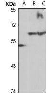 PSMD5 antibody