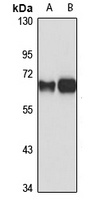 Anti-PSPC1 Antibody