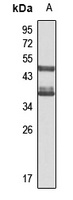 Anti-PTCD2 Antibody