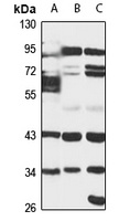 PTGR1 antibody