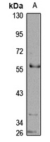 Anti-PTPN18 Antibody