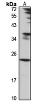 Anti-PTRH1 Antibody