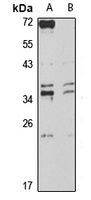 Anti-PURA Antibody