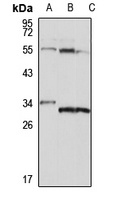 Anti-PYCR2 Antibody