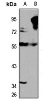 Anti-QRSL1 Antibody