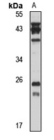 RAB28 antibody