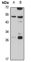 RAB34 antibody