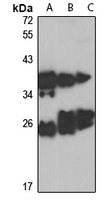 RAB5B antibody