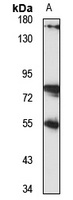 Anti-RABGGTA Antibody